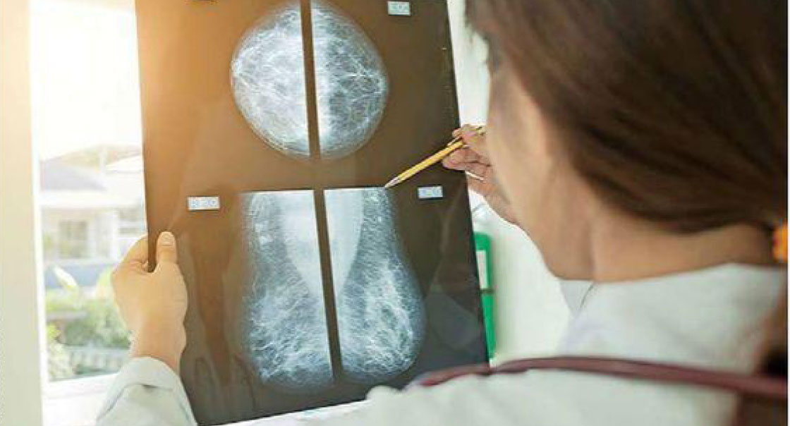 Conac: consulta precoz y exámenes periódicos son clave para detectar cáncer de mama oportunamente